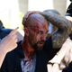 Police escort wounded man away from in front of the Capitol in Sacramento, Calif., on June 26, 2016, after members of right-wing extremist groups holding a rally outside the California Capitol clashed with counterprotesters. (Steven Styles/AP Images)
